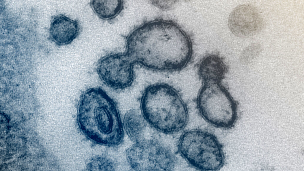 Here’s how coronavirus may actually be getting more like flu – Stat News